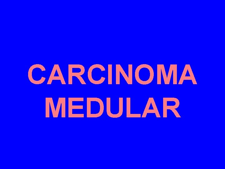 CARCINOMA MEDULAR 