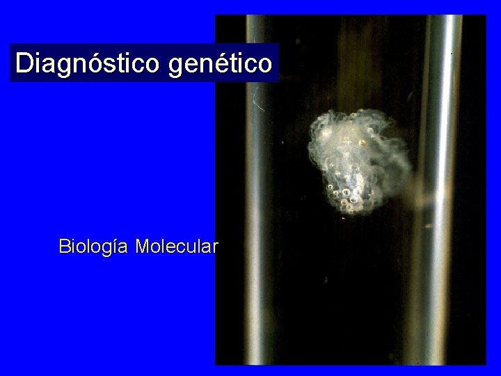Diagnóstico genético Biología Molecular ADN 