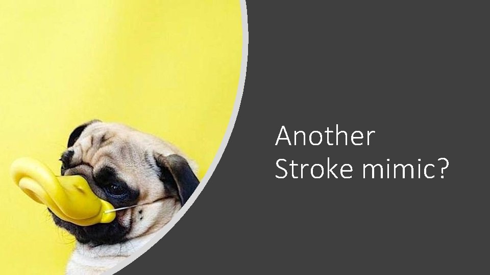 Another Stroke mimic? Another Stroke mimic?