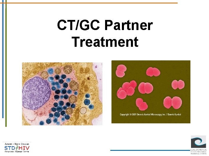 CT/GC Partner Treatment 