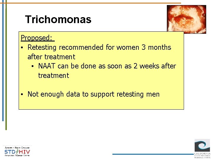 Trichomonas Proposed: • Retesting recommended for women 3 months after treatment • NAAT can