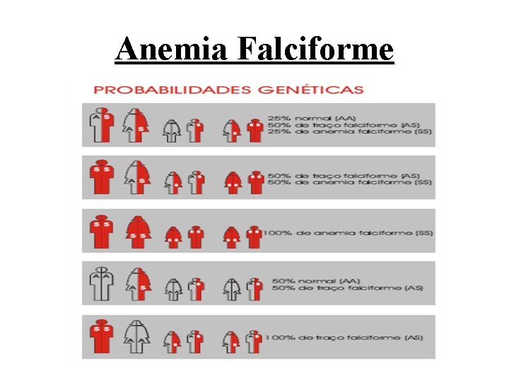 Anemia Falciforme 