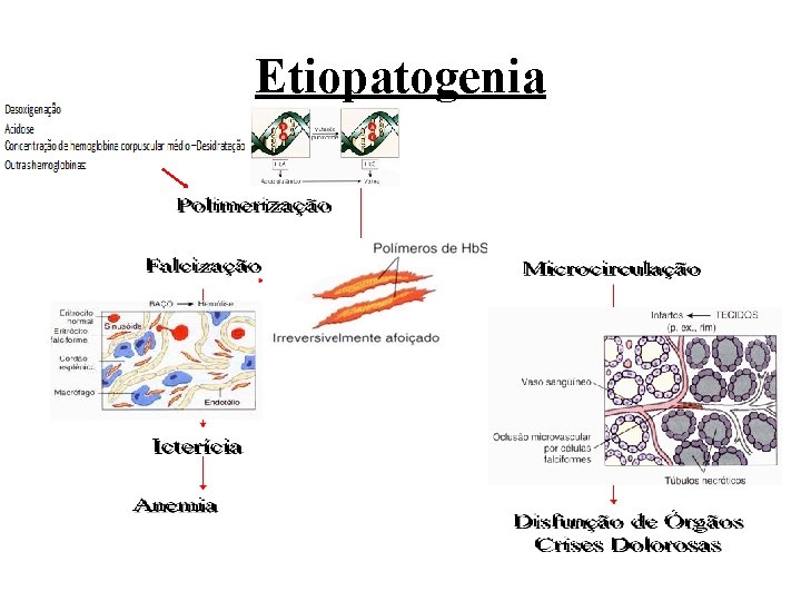 Etiopatogenia 