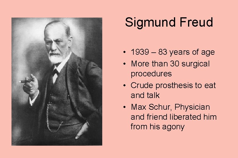 Sigmund Freud • 1939 – 83 years of age • More than 30 surgical