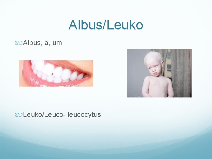 Albus/Leuko Albus, a, um Leuko/Leuco- leucocytus 