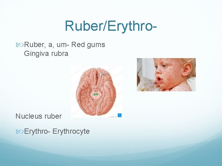 Ruber/Erythro Ruber, a, um- Red gums Gingiva rubra Rubeola Nucleus ruber Erythro- Erythrocyte 