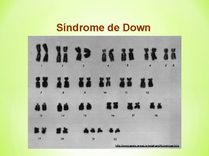 Síndrome de Down http: //www. assis. unesp. br/egalhard/Numericas. htm 