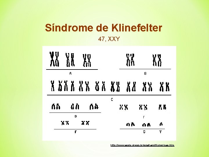 Síndrome de Klinefelter 47, XXY http: //www. assis. unesp. br/egalhard/Numericas. htm 