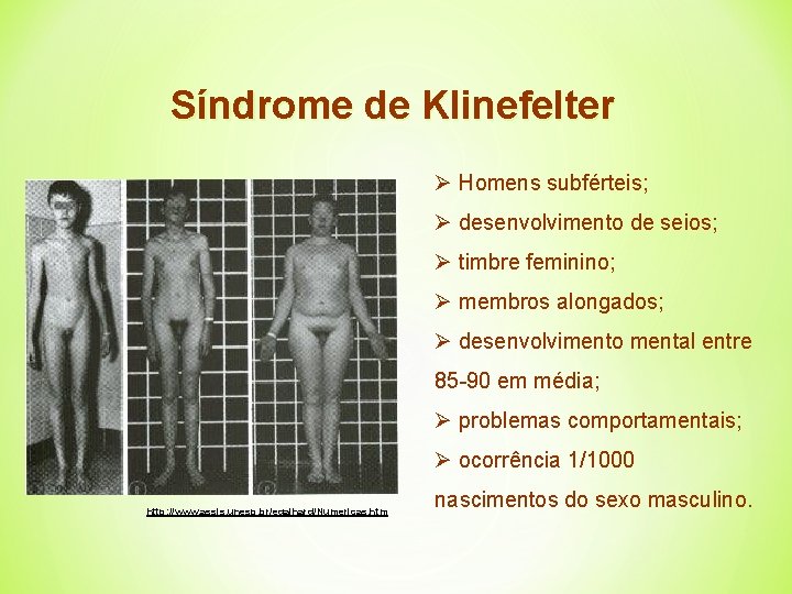 Síndrome de Klinefelter Ø Homens subférteis; Ø desenvolvimento de seios; Ø timbre feminino; Ø