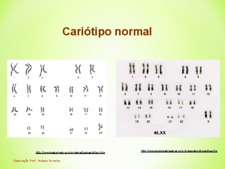 Cariótipo normal http: //www. saberweb. com. br/genetica/cariotipo. htm Elaboração Prof. Viviane Ferreira http: //www.