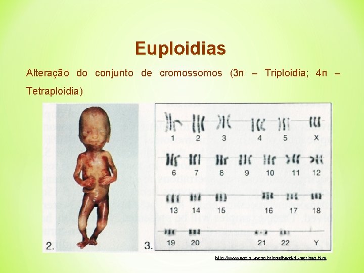 Euploidias Alteração do conjunto de cromossomos (3 n – Triploidia; 4 n – Tetraploidia)