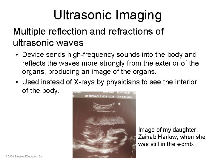 Ultrasonic Imaging Multiple reflection and refractions of ultrasonic waves • Device sends high-frequency sounds