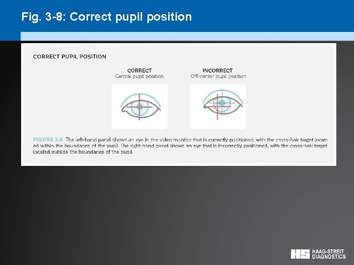 Fig. 3 -8: Correct pupil position 