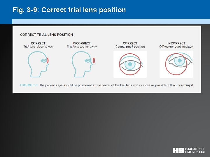 Fig. 3 -9: Correct trial lens position 