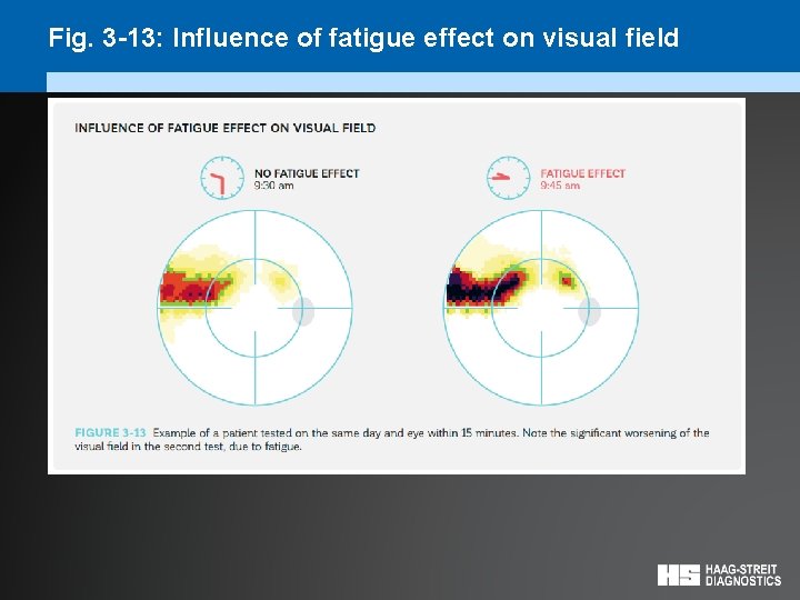 Fig. 3 -13: Influence of fatigue effect on visual field 