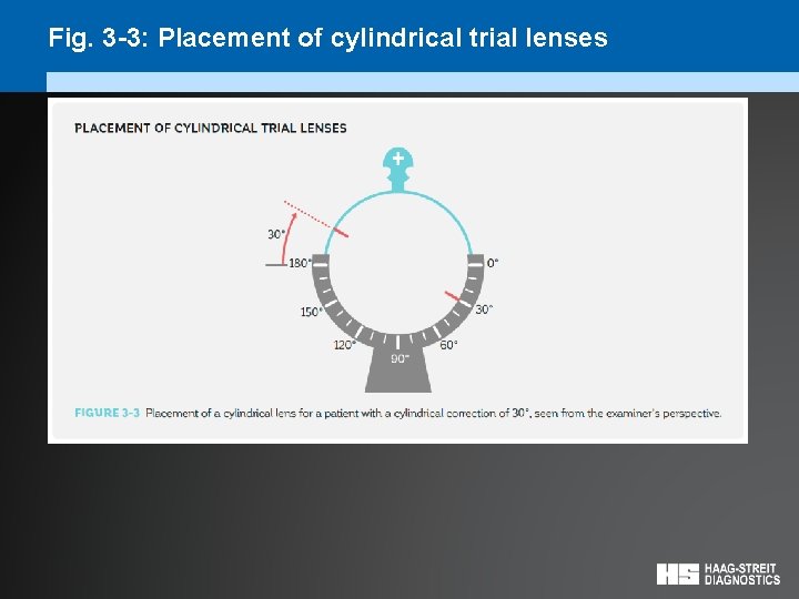 Fig. 3 -3: Placement of cylindrical trial lenses 