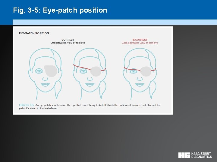 Fig. 3 -5: Eye-patch position 