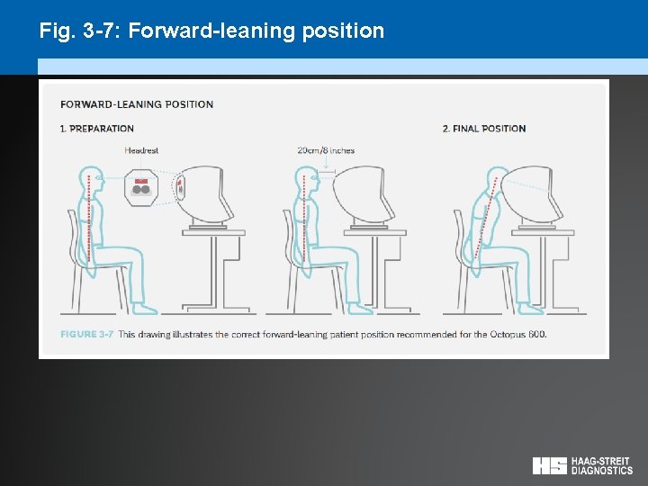 Fig. 3 -7: Forward-leaning position 