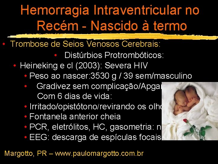Hemorragia Intraventricular no Recém - Nascido à termo • Trombose de Seios Venosos Cerebrais: