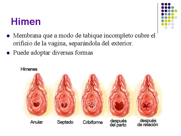 Himen l l Membrana que a modo de tabique incompleto cubre el orificio de