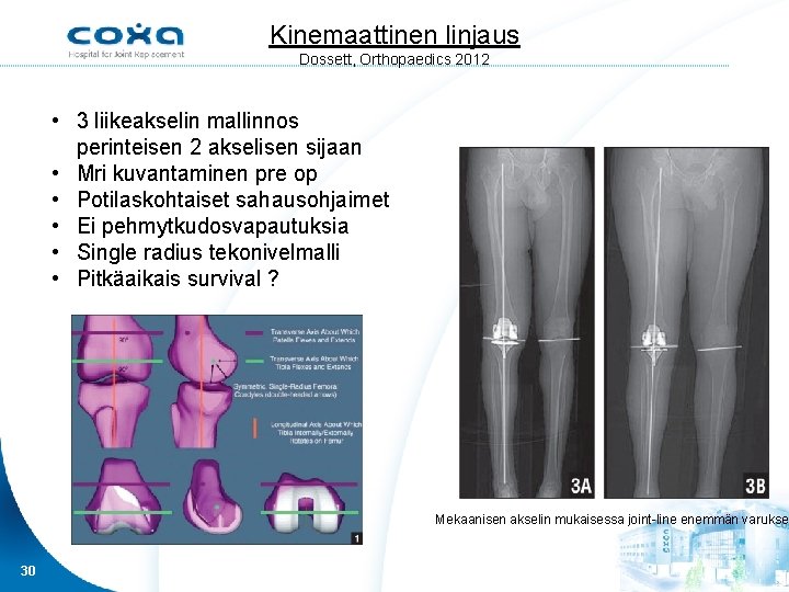 Kinemaattinen linjaus Dossett, Orthopaedics 2012 • 3 liikeakselin mallinnos perinteisen 2 akselisen sijaan •