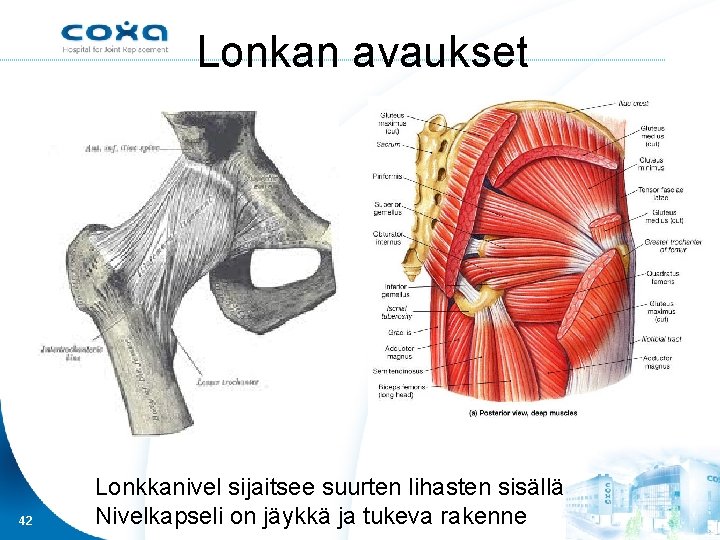 Lonkan avaukset 42 Lonkkanivel sijaitsee suurten lihasten sisällä Nivelkapseli on jäykkä ja tukeva rakenne