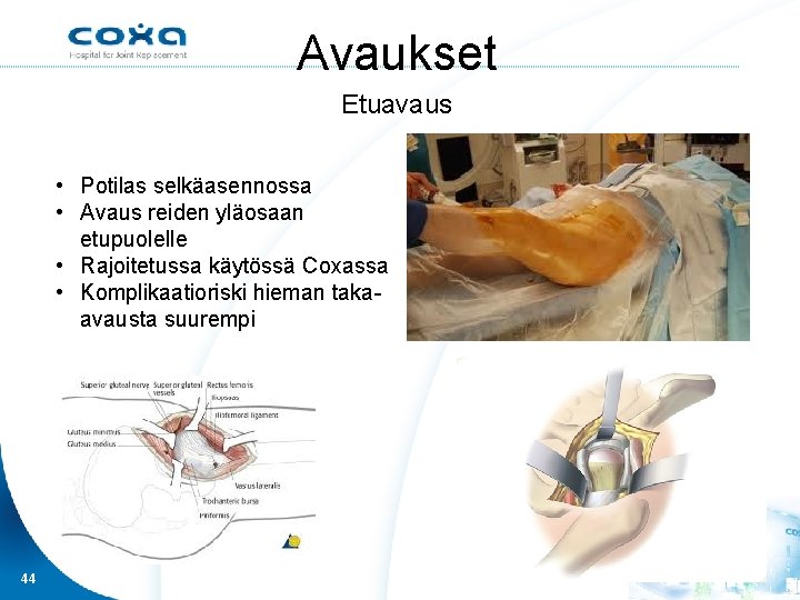 Avaukset Etuavaus • Potilas selkäasennossa • Avaus reiden yläosaan etupuolelle • Rajoitetussa käytössä Coxassa