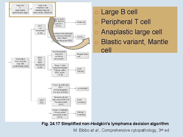  Large B cell Peripheral T cell Anaplastic large cell Blastic variant, Mantle cell