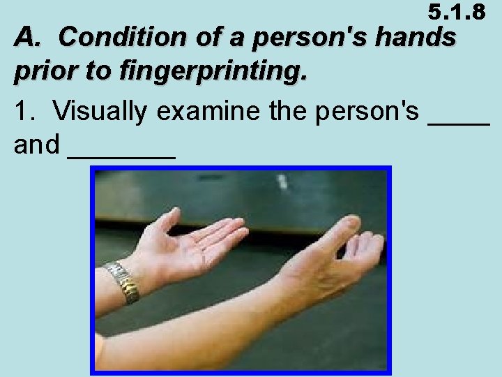 5. 1. 8 A. Condition of a person's hands prior to fingerprinting. 1. Visually