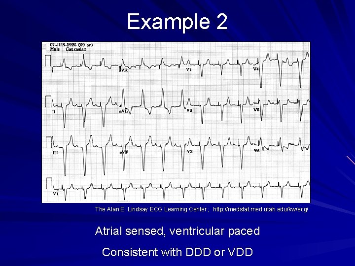 Example 2 The Alan E. Lindsay ECG Learning Center ; http: //medstat. med. utah.