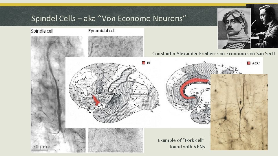 Spindel Cells – aka “Von Economo Neurons” Constantin von. Economo San Serff Constantin Alexander