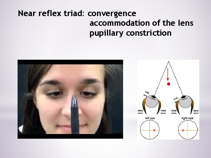 Near reflex triad: convergence accommodation of the lens pupillary constriction 