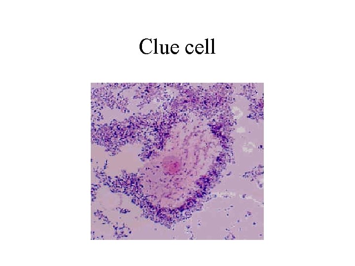 Clue cell 