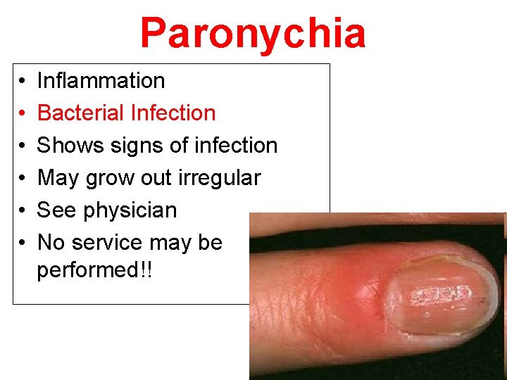 Paronychia • • • Inflammation Bacterial Infection Shows signs of infection May grow out