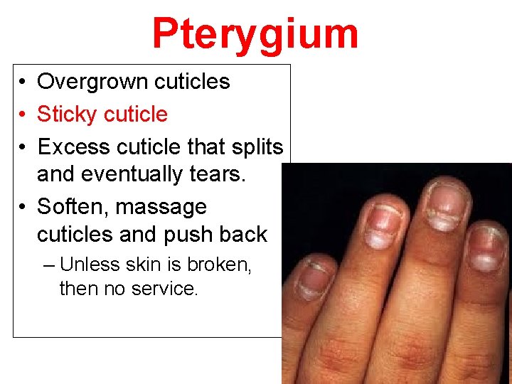 Pterygium • Overgrown cuticles • Sticky cuticle • Excess cuticle that splits and eventually