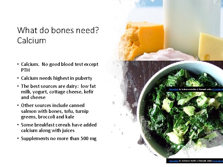 What do bones need? Calcium • Calcium. No good blood test except PTH •