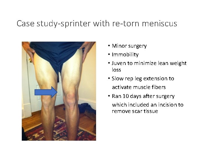 Case study-sprinter with re-torn meniscus • Minor surgery • Immobility • Juven to minimize