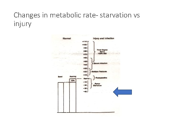 Changes in metabolic rate- starvation vs injury 