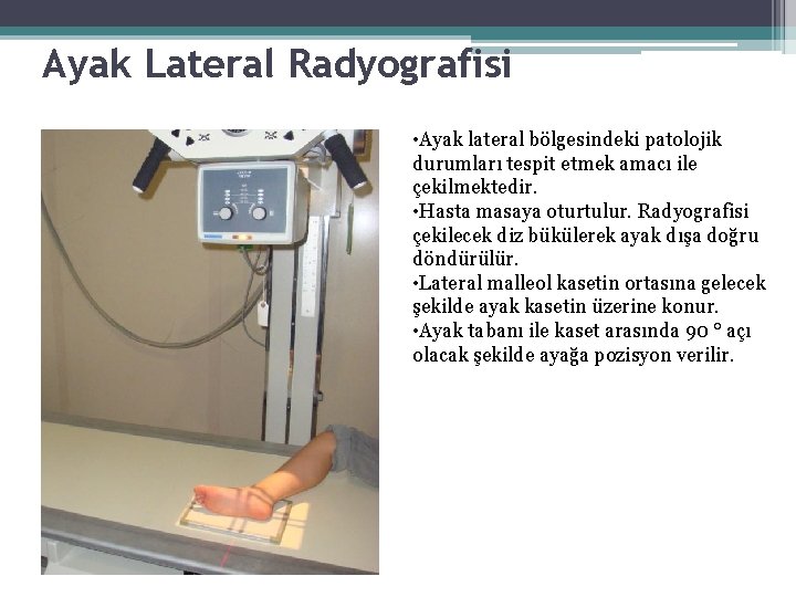 Ayak Lateral Radyografisi • Ayak lateral bölgesindeki patolojik durumları tespit etmek amacı ile çekilmektedir. Ayak Lateral Radyografisi • Ayak lateral bölgesindeki patolojik durumları tespit etmek amacı ile çekilmektedir.