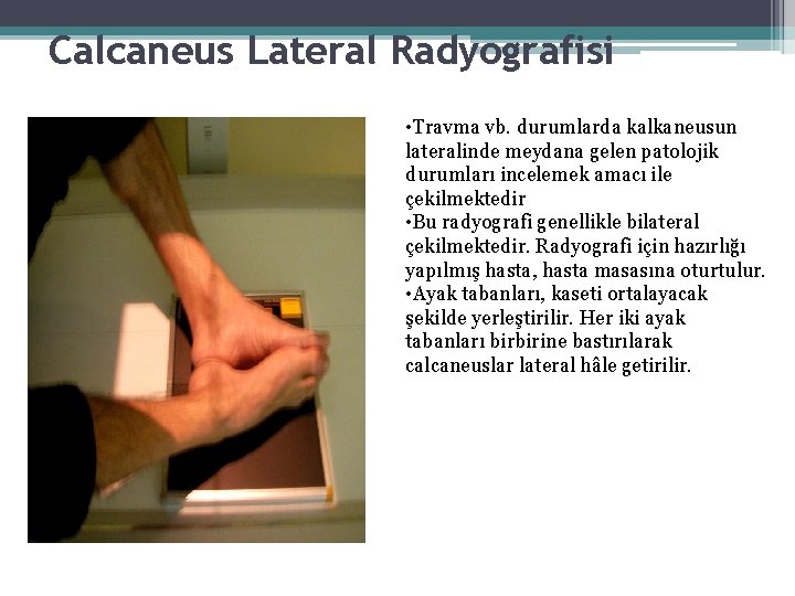 Calcaneus Lateral Radyografisi • Travma vb. durumlarda kalkaneusun lateralinde meydana gelen patolojik durumları incelemek Calcaneus Lateral Radyografisi • Travma vb. durumlarda kalkaneusun lateralinde meydana gelen patolojik durumları incelemek