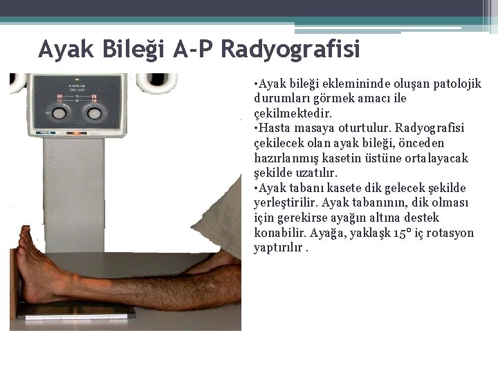 Ayak Bileği A-P Radyografisi • Ayak bileği eklemininde oluşan patolojik durumları görmek amacı ile Ayak Bileği A-P Radyografisi • Ayak bileği eklemininde oluşan patolojik durumları görmek amacı ile