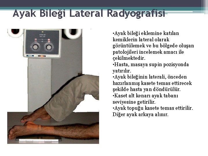 Ayak Bileği Lateral Radyografisi • Ayak bileği eklemine katılan kemiklerin lateral olarak görüntülemek ve Ayak Bileği Lateral Radyografisi • Ayak bileği eklemine katılan kemiklerin lateral olarak görüntülemek ve