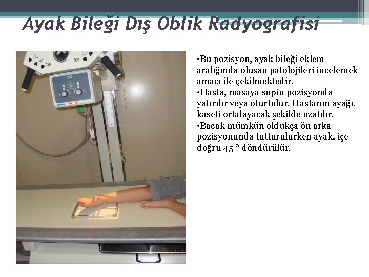 Ayak Bileği Dış Oblik Radyografisi • Bu pozisyon, ayak bileği eklem aralığında oluşan patolojileri Ayak Bileği Dış Oblik Radyografisi • Bu pozisyon, ayak bileği eklem aralığında oluşan patolojileri