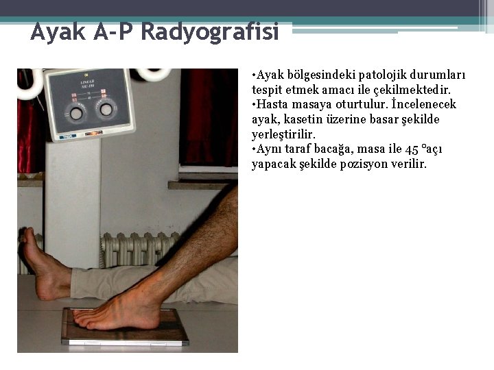 Ayak A-P Radyografisi • Ayak bölgesindeki patolojik durumları tespit etmek amacı ile çekilmektedir. • Ayak A-P Radyografisi • Ayak bölgesindeki patolojik durumları tespit etmek amacı ile çekilmektedir. •
