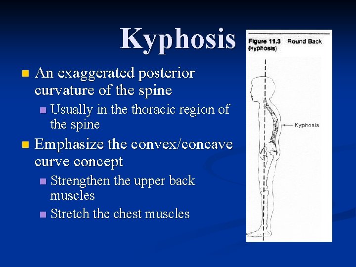 Kyphosis n An exaggerated posterior curvature of the spine n n Usually in the