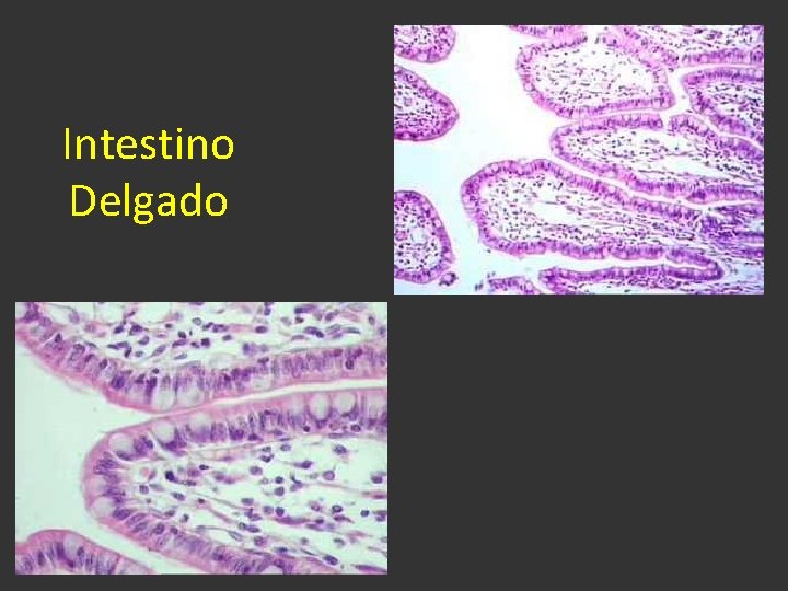 Intestino Delgado 