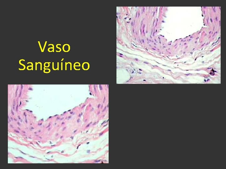Vaso Sanguíneo 