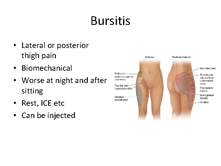Bursitis • Lateral or posterior thigh pain • Biomechanical • Worse at night and Bursitis • Lateral or posterior thigh pain • Biomechanical • Worse at night and