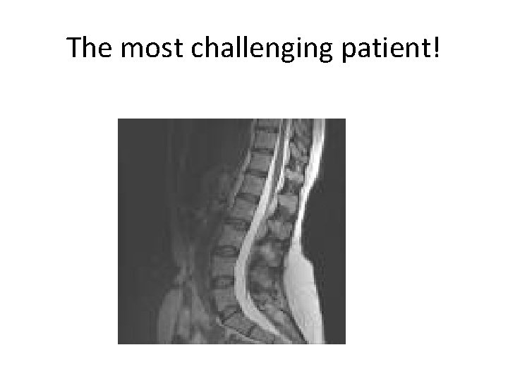 The most challenging patient! The most challenging patient!