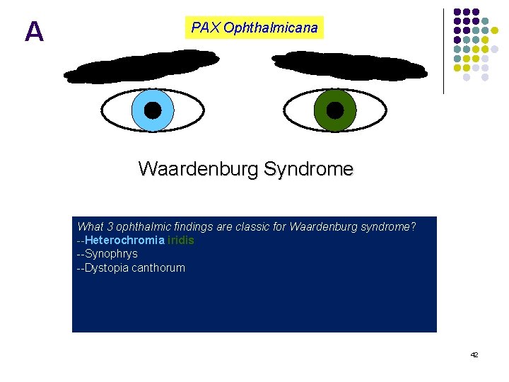 A PAX Ophthalmicana Waardenburg Syndrome What 3 ophthalmic findings are classic for Waardenburg syndrome?
